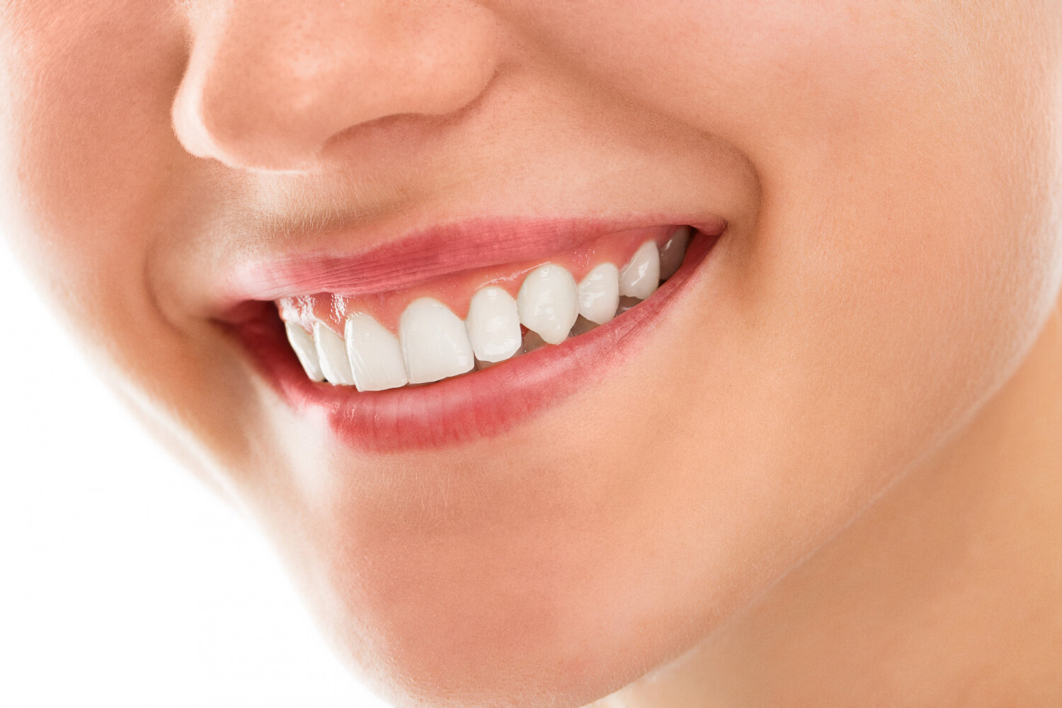 Affordable Teeth Whitening Solutions A Budget-Friendly Path to a Radiant Smile with Mylifesmiles