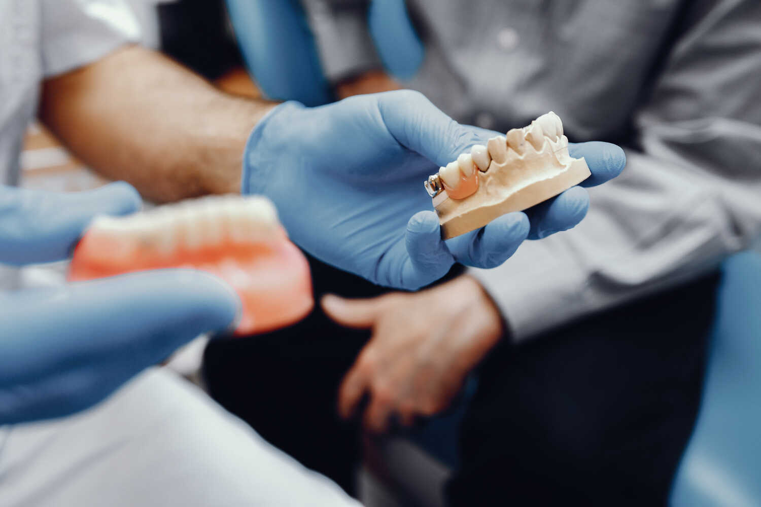 Bridging the Gap Dental Bridge vs Implant